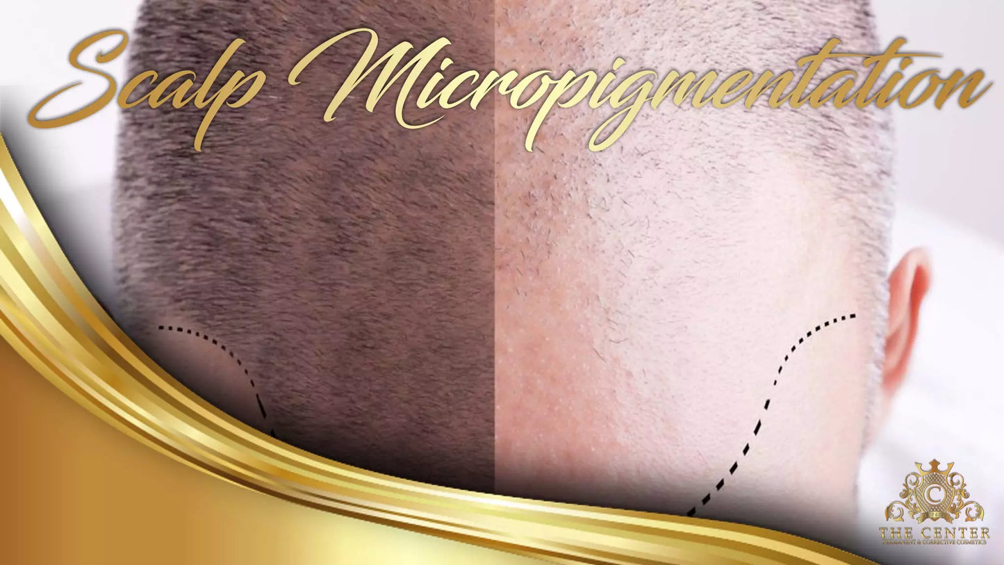 Scalp Micropigmentation Course